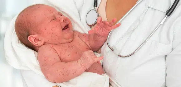 Quels sont les vaccins obligatoires pour commencer l’école ?